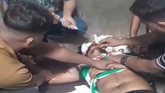 মাদ্রাসা শিক্ষার্থীর শ্বাসনালী কেটে দিয়েছে কিশোর গ্যাং সদস্যরা